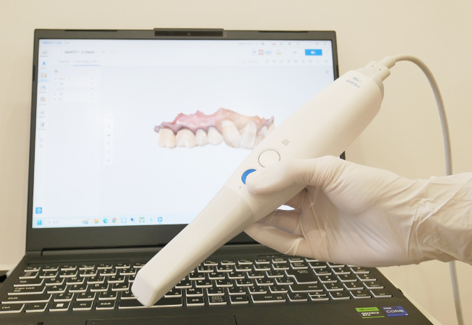 口腔内スキャナー